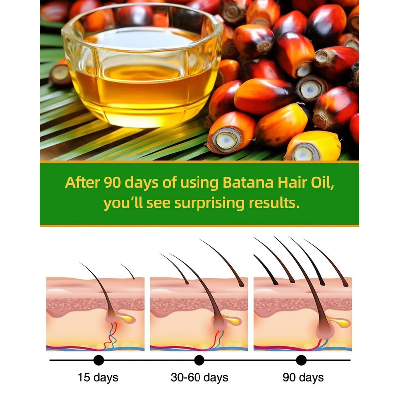Batana Rosemary Hair Care Esse - Rosemary Hair Oil ulasan dan harga