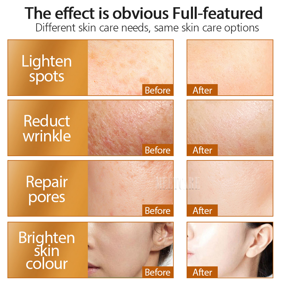 ZGTS 192pin Derma Roller Micro - Hair Care Tips ulasan dan harga