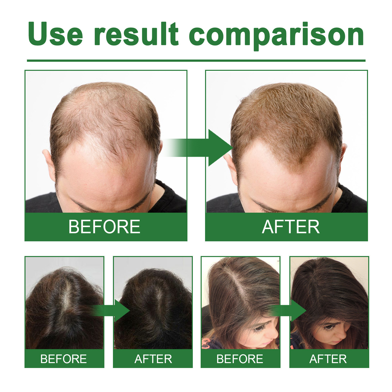 Rosemary Spray for Hair Nouris - Hair Care Nature ulasan dan harga